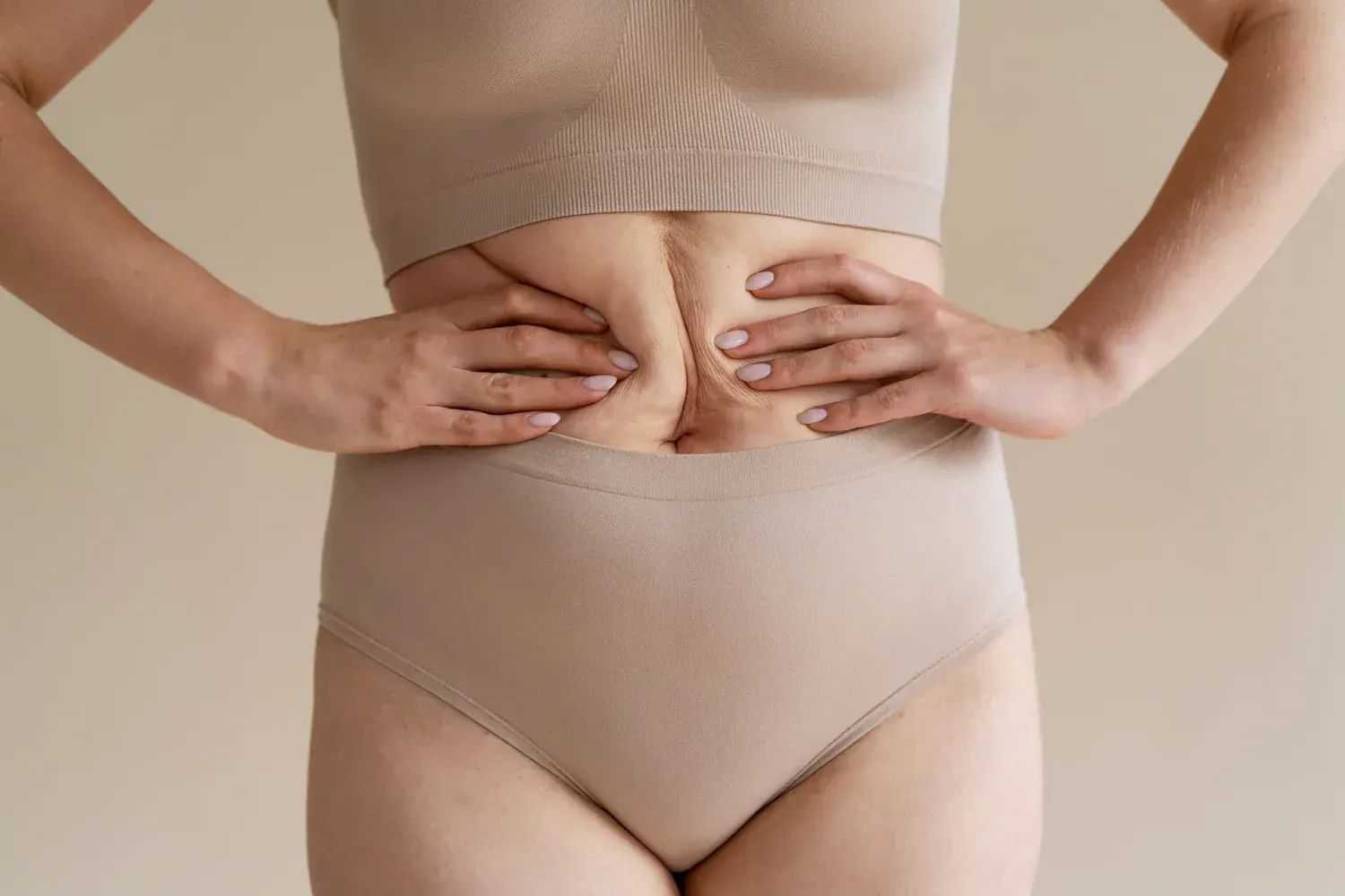Root causes of postpartum diastasis recti